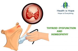 Thyroid_Homeopathy